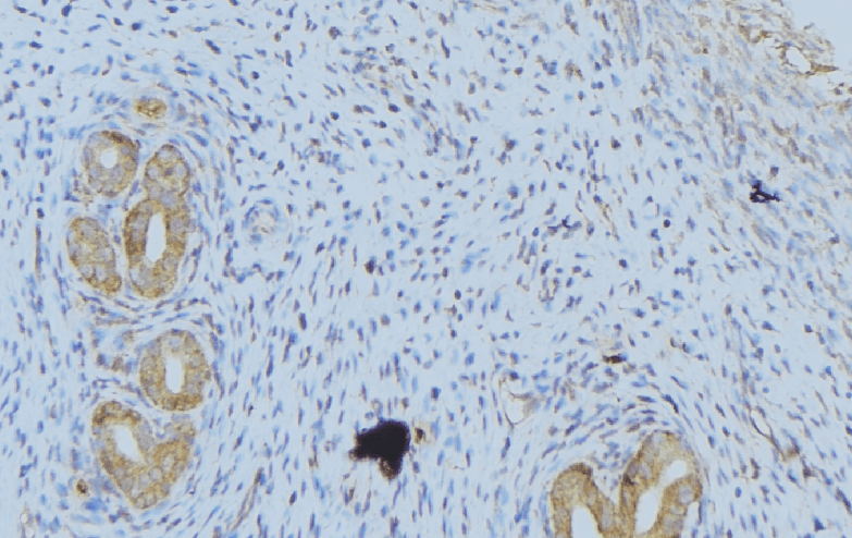 Polyclonal Rabbit anti-Human WNT1 Antibody (IHC, IF, WB)