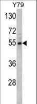 Polyclonal Rabbit anti-Human FSCN1 / Fascin Antibody (aa322-350, IHC, WB)