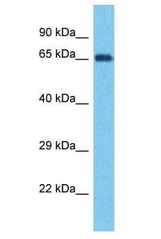 PTPN22 / PEP Antibody (aa361-410)