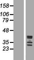 C19orf47 Protein (Over-Expression Lysate Myc-DDK (Flag))