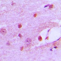 MSH6 Antibody (Internal)