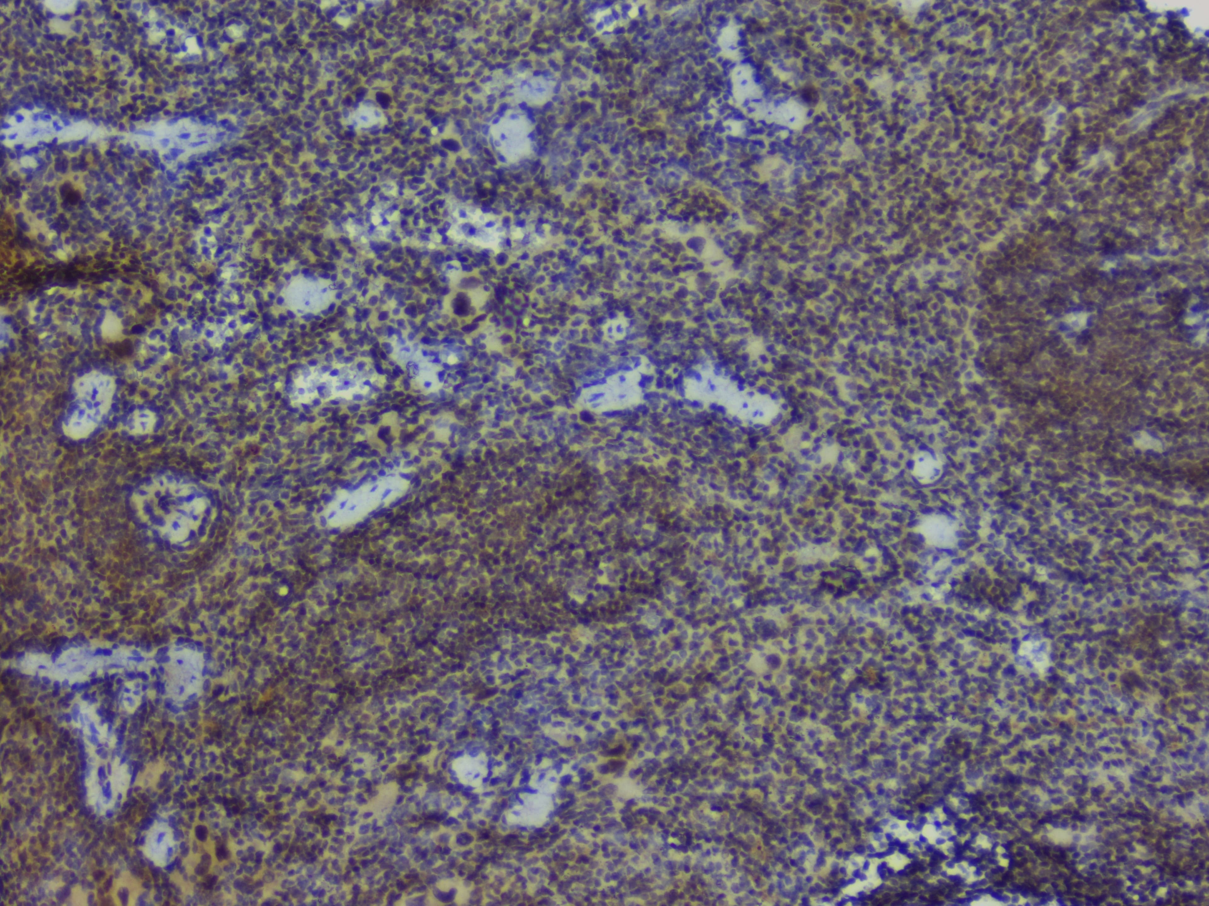 NRF1 / NRF-1 Antibody