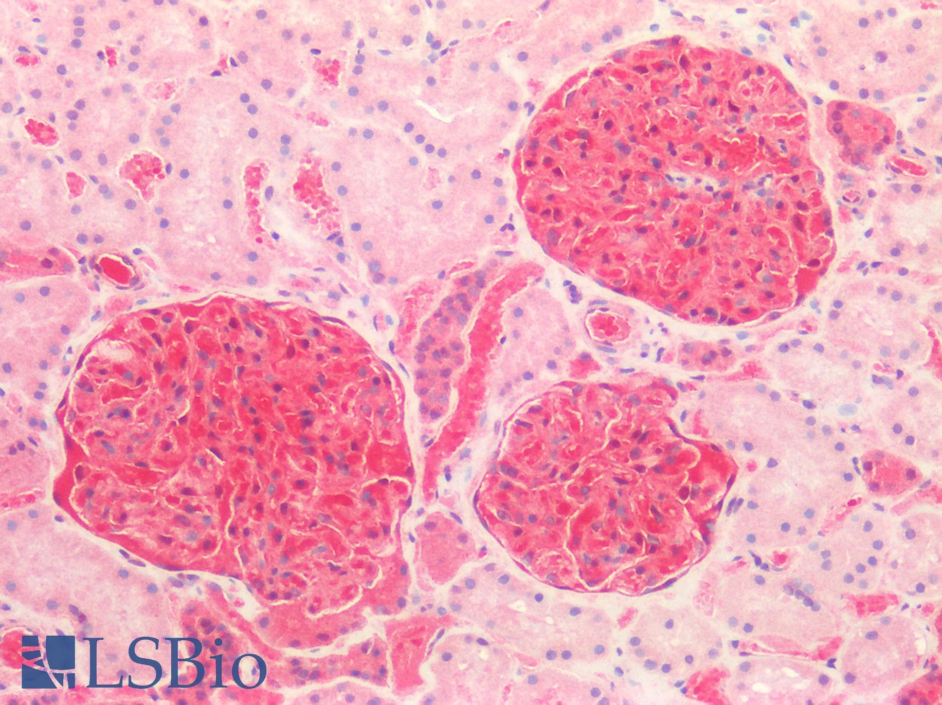Polyclonal Rabbit anti-Human S100A6 / Calcyclin Antibody (aa1-90, IHC, WB)