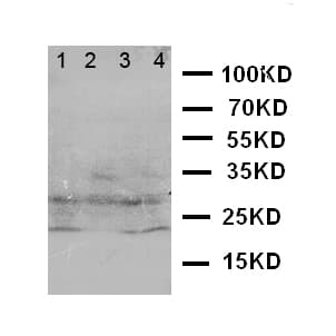 CA3 / Carbonic Anhydrase III Antibody (aa2-20)