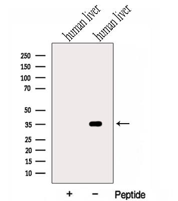 Polyclonal Rabbit anti-Human HSD17B6 Antibody (WB)