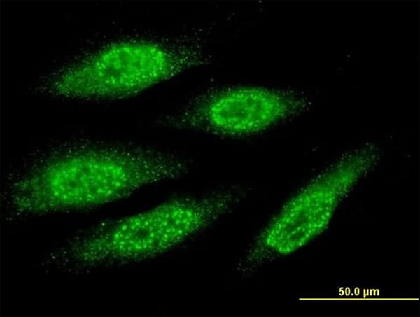 MAGEA8 Antibody (clone 3F7)