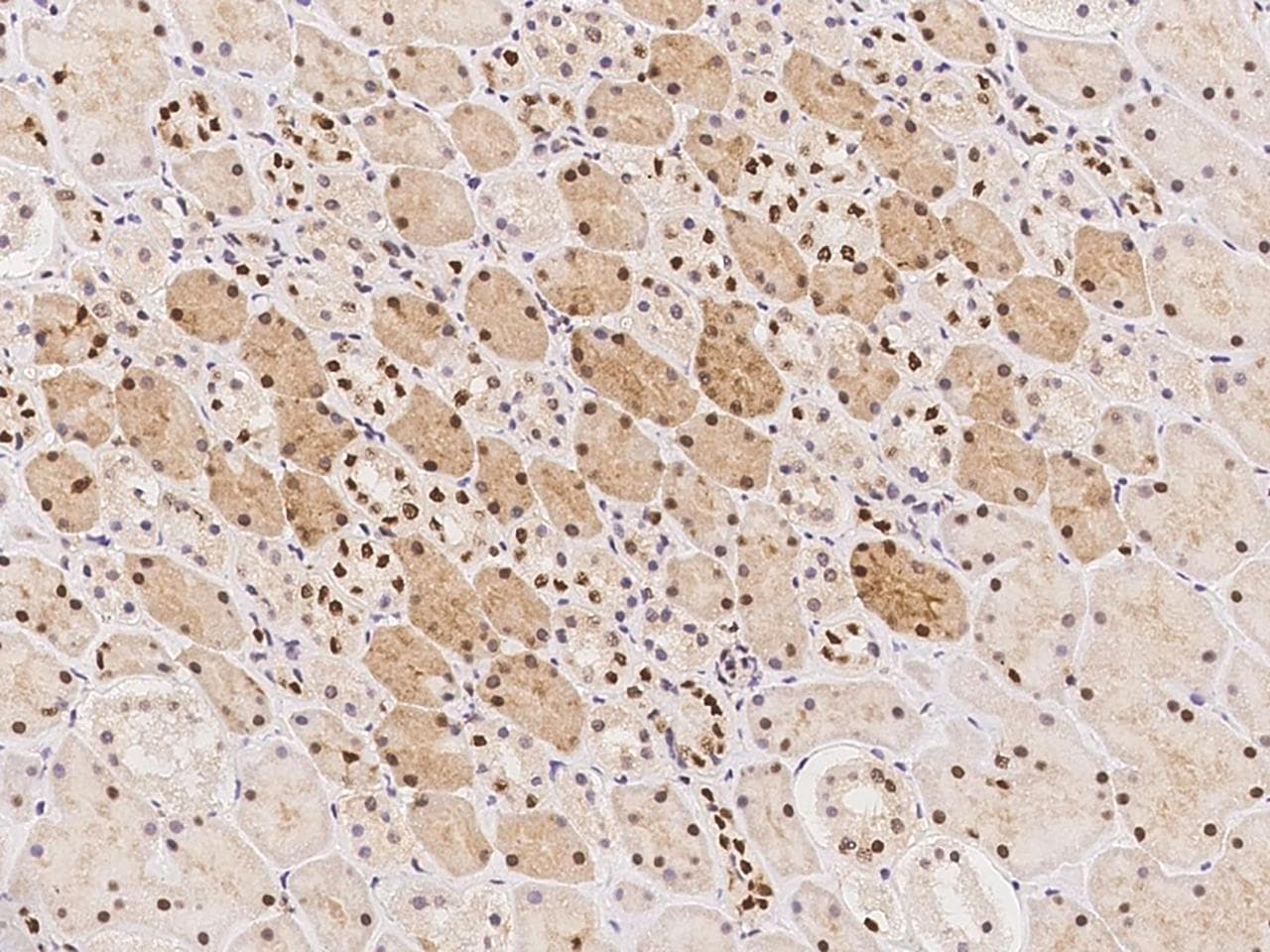Polyclonal Rabbit anti-Human TMEM49 Antibody (IHC)