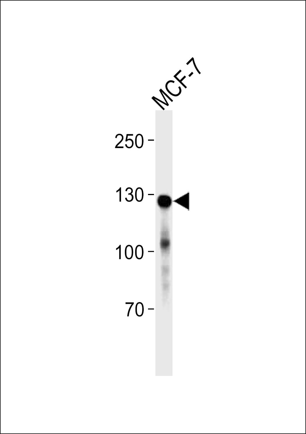 Monoclonal Mouse anti-Human CDH1 / E Cadherin Antibody (clone 813CT11.1.3, WB)