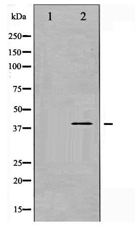Polyclonal Rabbit anti-Human MAP2K3 / MEK3 / MKK3 Antibody (phospho-Ser189, IHC, WB)