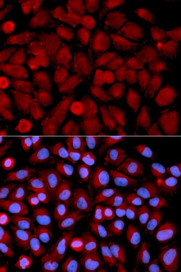 MAPK9 / JNK2 Antibody