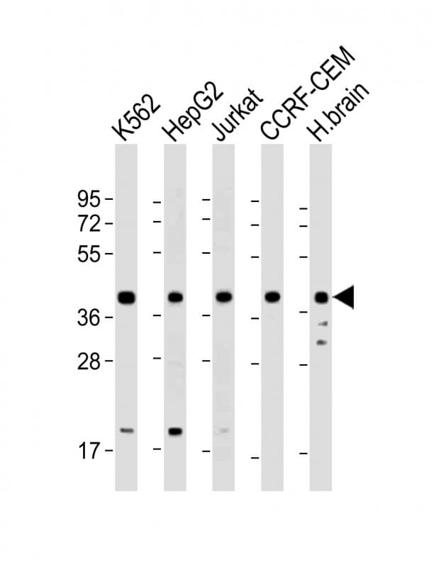 PPID / Cyclophilin D Antibody