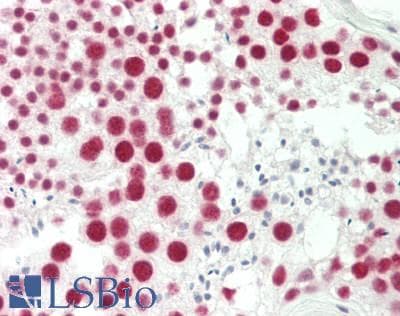 IHC-plus™ Polyclonal Rabbit anti-Human TAF15 Antibody (aa175-225, IHC, WB)
