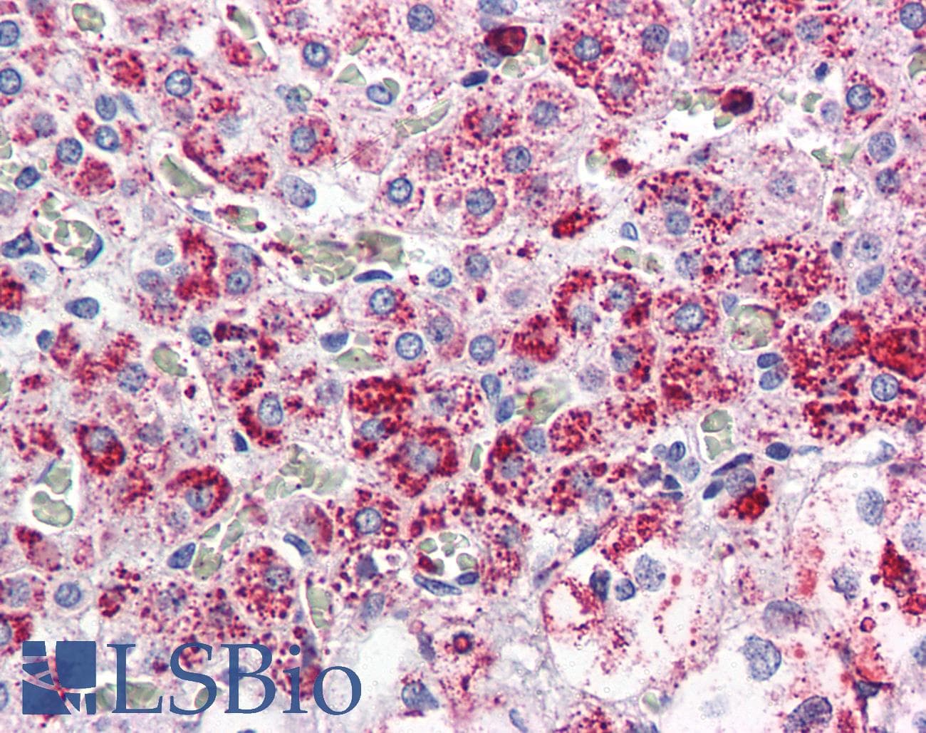 IHC-plus™ CCKAR / CCK1R Antibody (Internal)