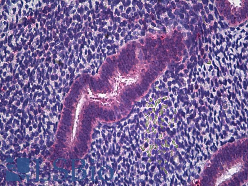 IHC-plus™ Polyclonal Rabbit anti-Human CD225 / IFITM1 Antibody (IHC, IF, WB)