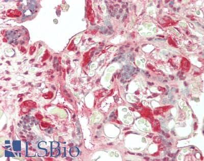 IHC-plus™ PSMA3 Antibody
