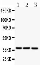 CD79B / CD79 Beta Antibody (aa29-229)