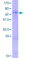 Human ARHGEF40 / SOLO Protein (Recombinant GST)