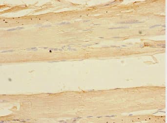 TOB2 Antibody