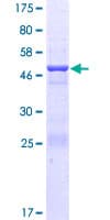 Human CCDC46 Protein (Recombinant GST)