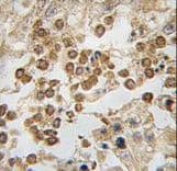 DPPA4 Antibody (aa50-79)
