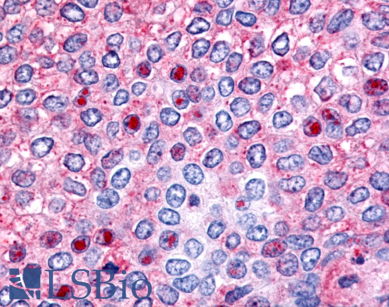 PathPlus™ HNF4G / HNF4 Gamma Antibody (Ligand-binding Domain)