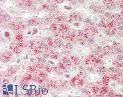 IHC-plus™ GSTT2 Antibody (aa113-141)