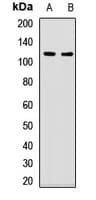 UBA1 / UBE1 Antibody