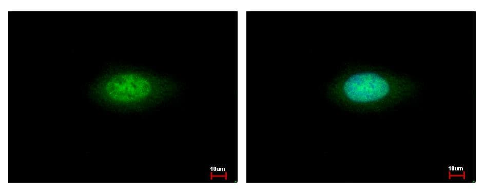 ANXA7 / Annexin VII / SNX Antibody (aa122-459)