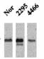 CAMK2 / CAMKII Antibody (phospho-Thr286/Thr287, clone 22B1)