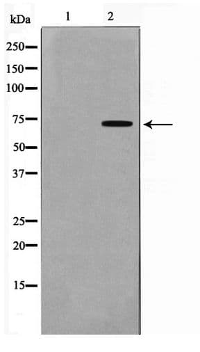 Polyclonal Rabbit anti-Human GUCY1B3 Antibody (IHC, WB)
