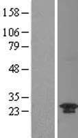 C20orf11 / TWA1 Protein (Over-Expression Lysate Myc-DDK (Flag))