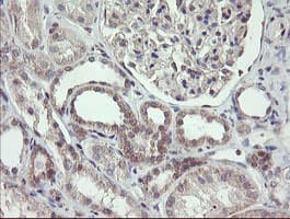 FBXO42 / JFK Antibody (clone OTI1H4)