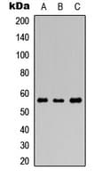 GABRR1 / GABA(A) Receptor rho- Antibody (N-Terminus)