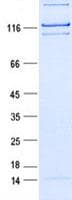 Human SRRT / ARS2 Protein (Recombinant DDK,C-terminus)