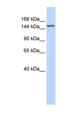 DGKeta / DGKH Antibody (aa648-697)