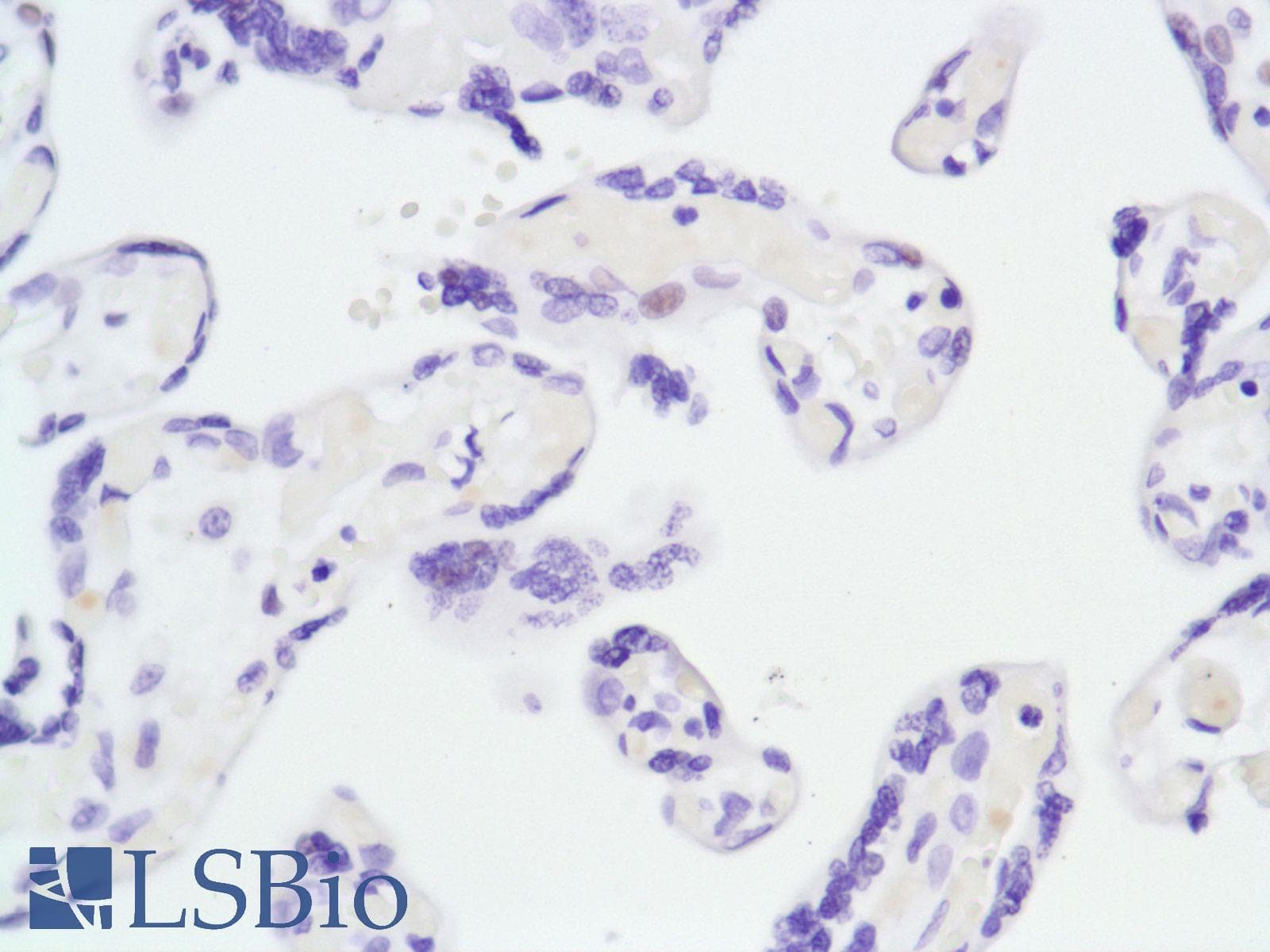 Monoclonal Rabbit anti-Human AR / Androgen Receptor Antibody (clone SP107, N-Terminus, IHC)