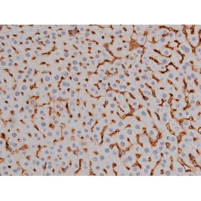 NPM1 / NPM / Nucleophosmin Antibody (phospho-Thr199)