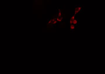 PDZD2 Antibody