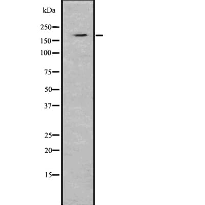 Complement C5 Antibody