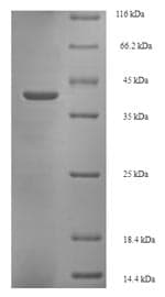 Cow GLTP Protein (Recombinant 6His-SUMO, N-terminus)