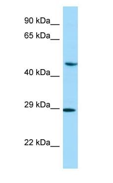NEIL1 Antibody (aa270-319)