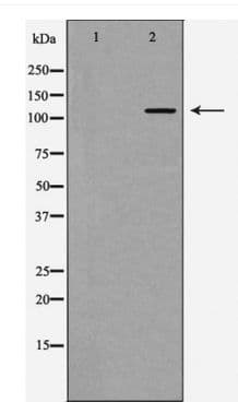 PIK3CA / PI3K Alpha Antibody