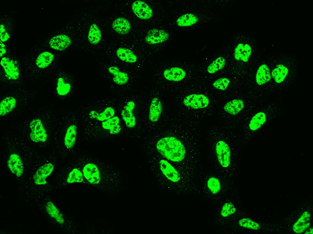 SF3B2 Antibody