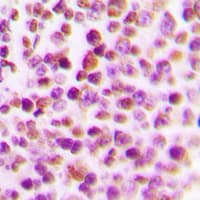 Polyclonal Rabbit anti-Human E2F4 Antibody (Internal, IHC, WB)