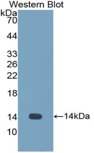 CST1 / Cystatin SN Antibody (aa21-141)