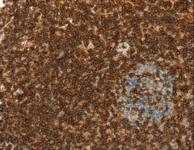 SPN / CD43 Antibody