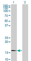 SNCG / Gamma-Synuclein Antibody (clone 2C3)