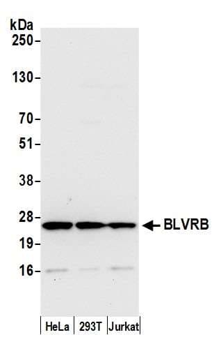 GHBP / BLVRB Antibody (aa156-206)