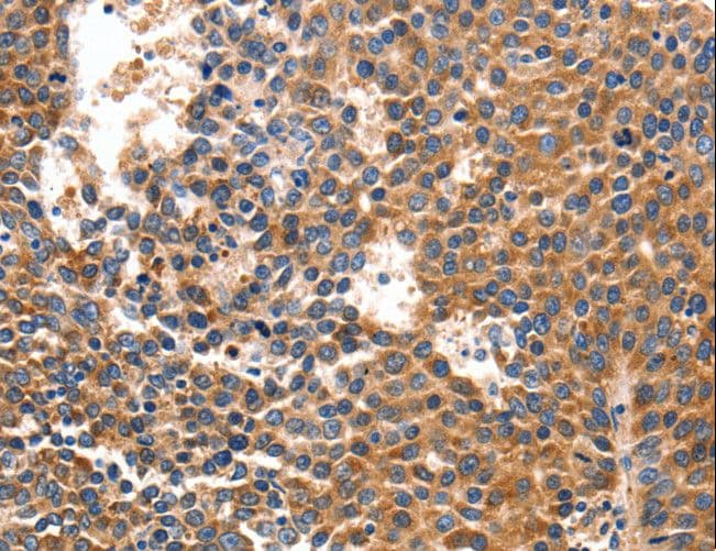 Polyclonal Rabbit anti-Human IRF1 / MAR Antibody (IHC, WB)
