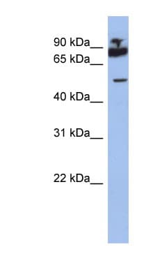 Polyclonal Rabbit anti-Human IKZF1 / IKAROS Antibody (aa395-444, WB)